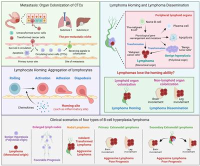 Lymphoma dissemination is a pathological hallmark for malignant progression of B-cell lymphoma